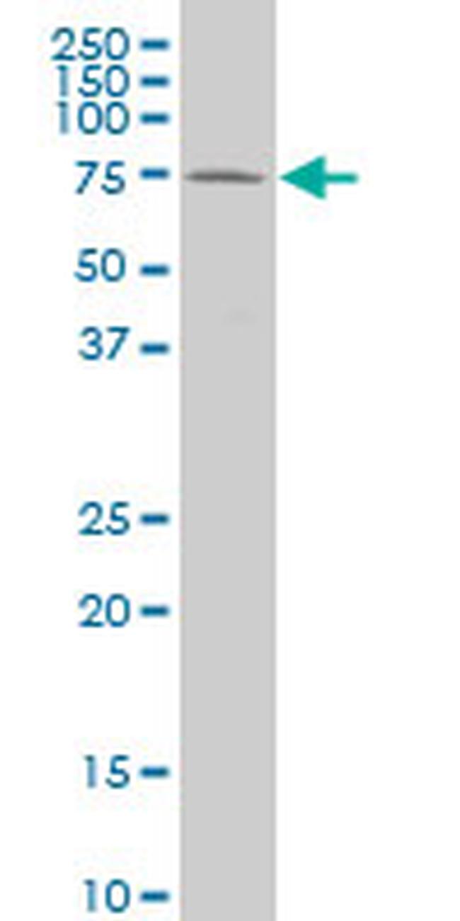 HCLS1 Antibody in Western Blot (WB)