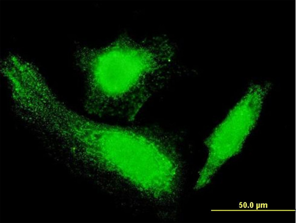 HD Antibody in Immunocytochemistry (ICC/IF)