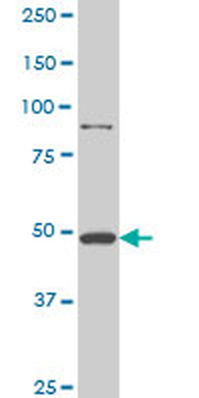 HD Antibody in Western Blot (WB)