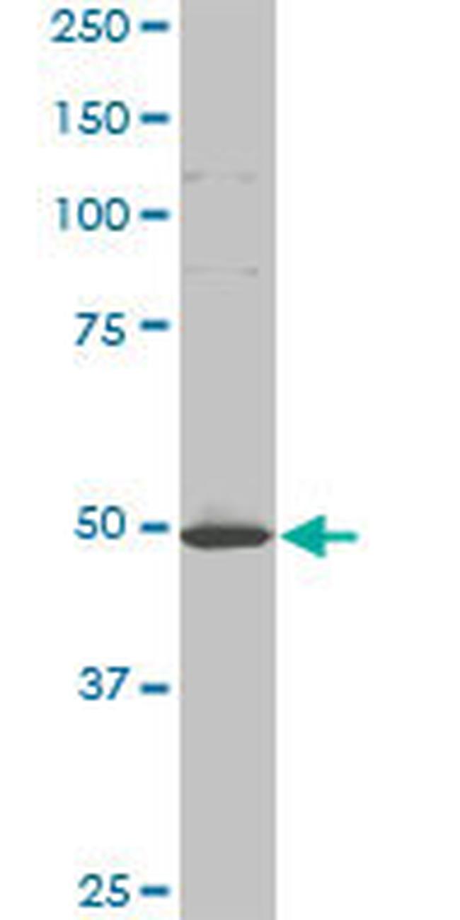 HD Antibody in Western Blot (WB)