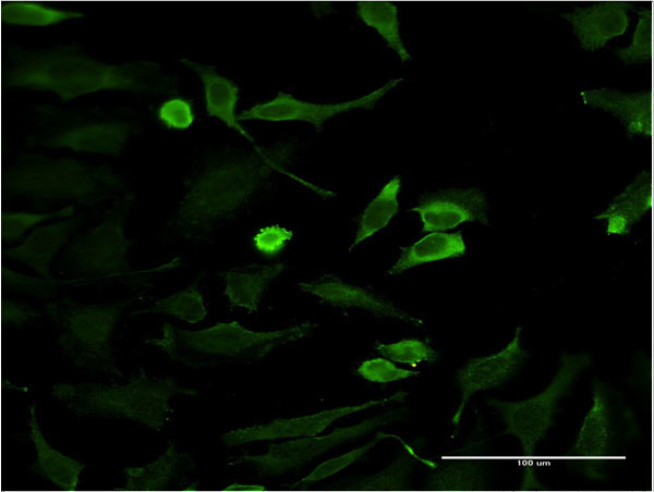 HD Antibody in Immunocytochemistry (ICC/IF)