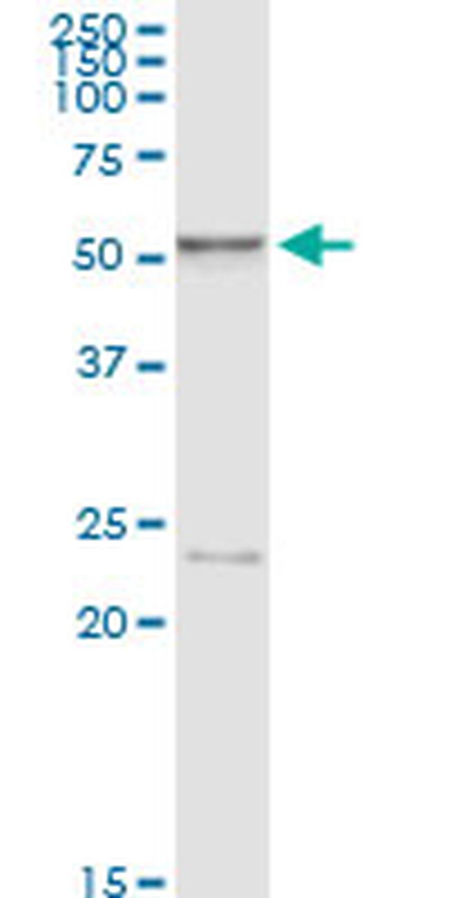 HEXA Antibody in Western Blot (WB)