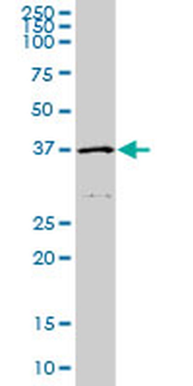 HFE Antibody in Western Blot (WB)