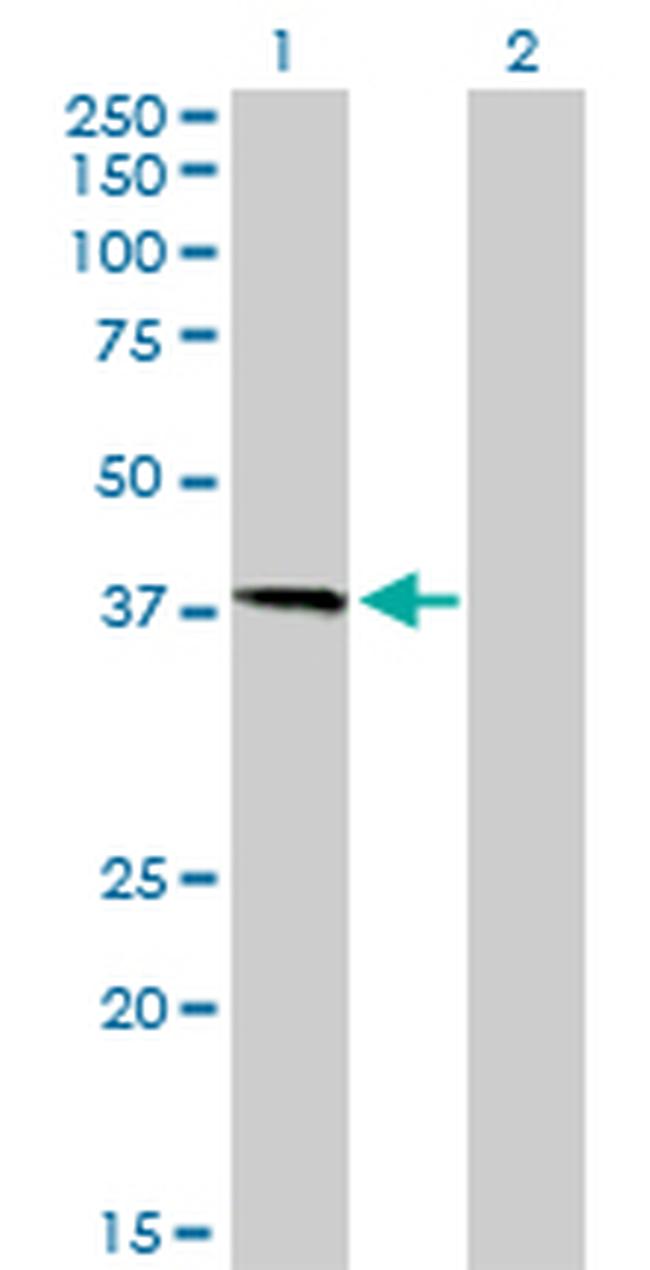 HFE Antibody in Western Blot (WB)