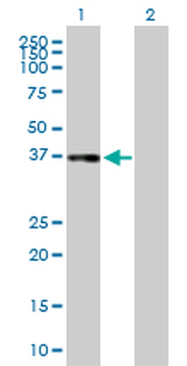 CFHR1 Antibody in Western Blot (WB)