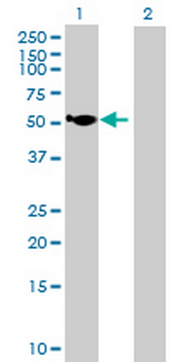 HGD Antibody in Western Blot (WB)