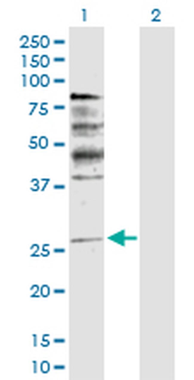 NRG1 Antibody in Western Blot (WB)