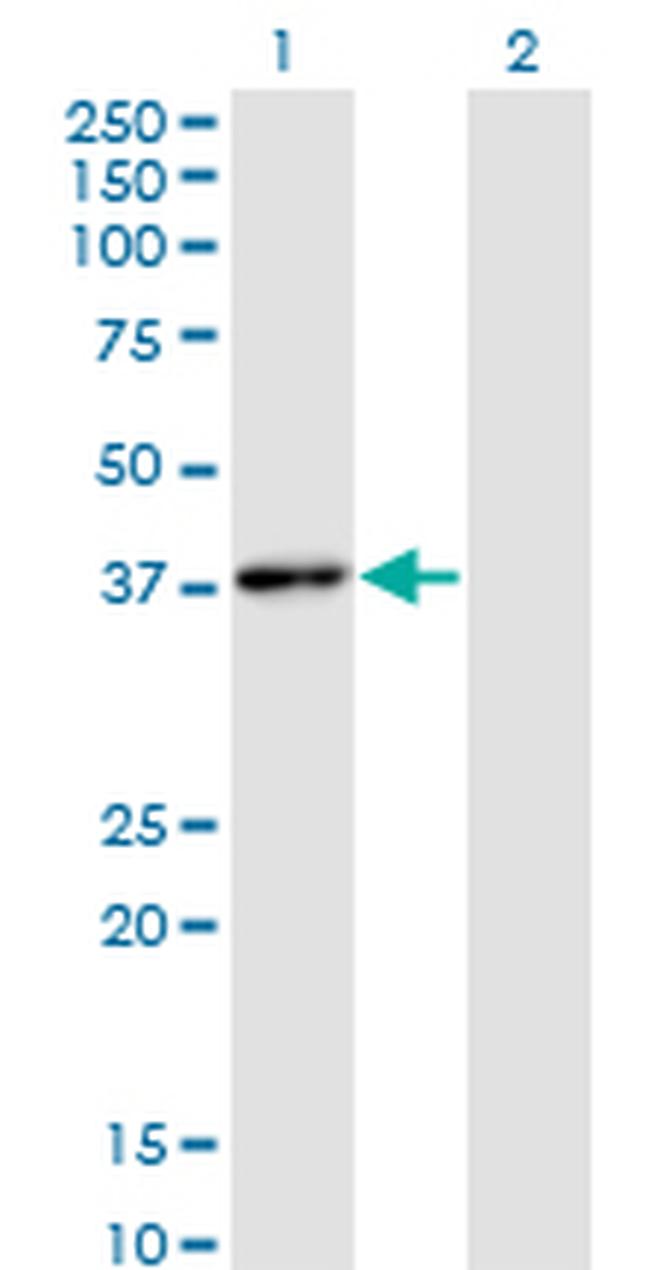 HHEX Antibody in Western Blot (WB)