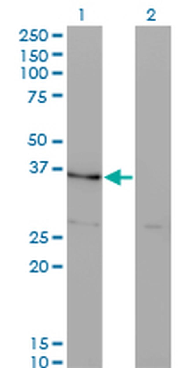 HHEX Antibody in Western Blot (WB)