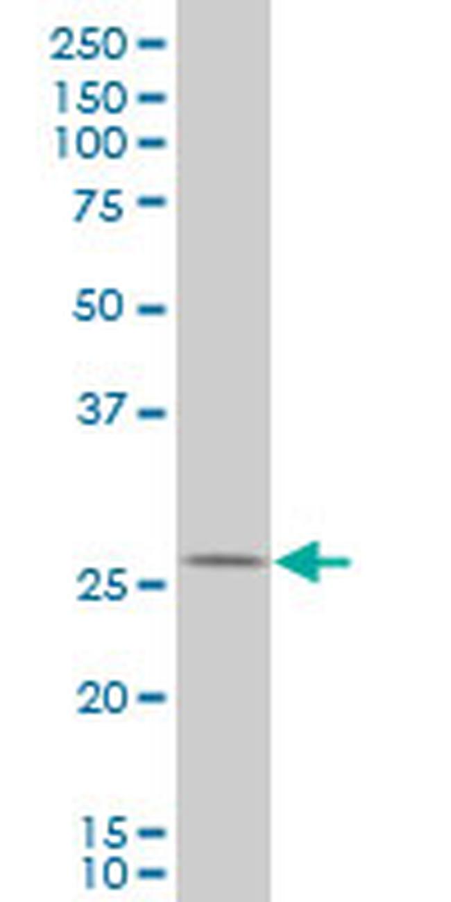 HHEX Antibody in Western Blot (WB)