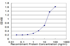 HIP1 Antibody in ELISA (ELISA)