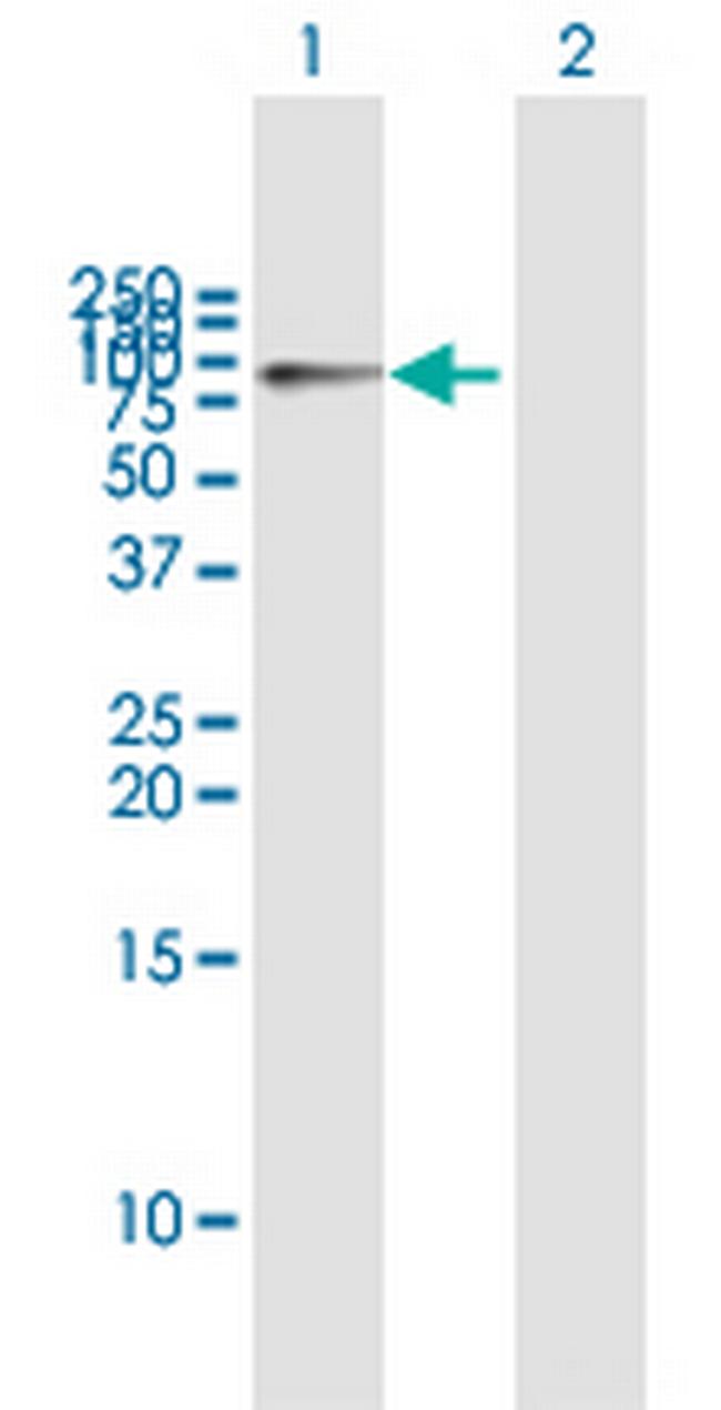 HK1 Antibody in Western Blot (WB)