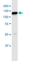 HK1 Antibody in Immunoprecipitation (IP)