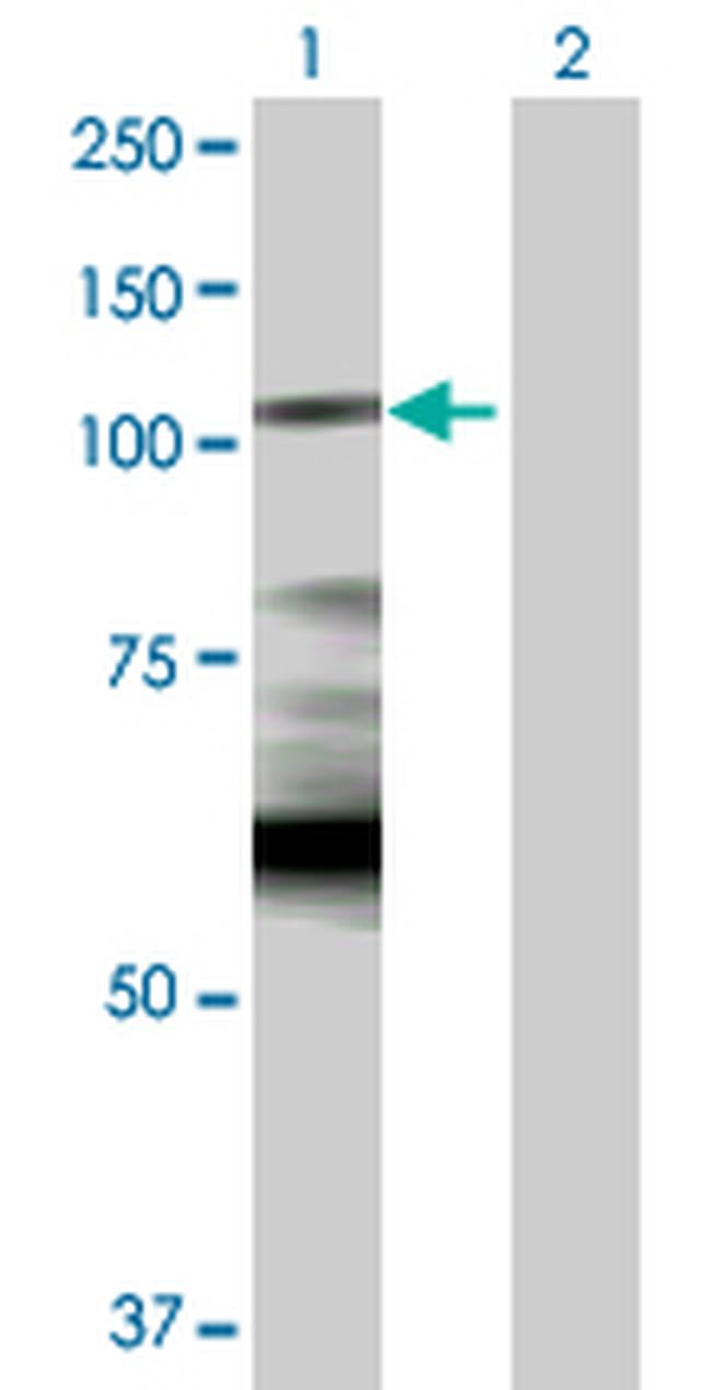 HK1 Antibody in Western Blot (WB)