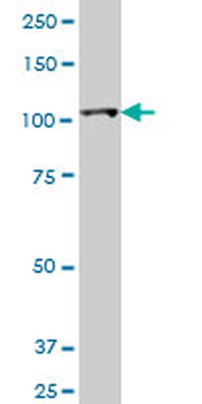 HK2 Antibody in Western Blot (WB)