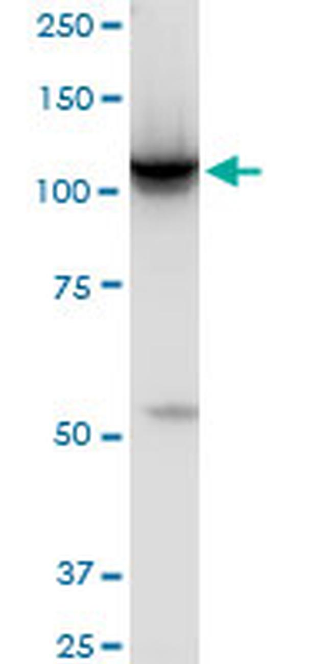 HK2 Antibody in Western Blot (WB)