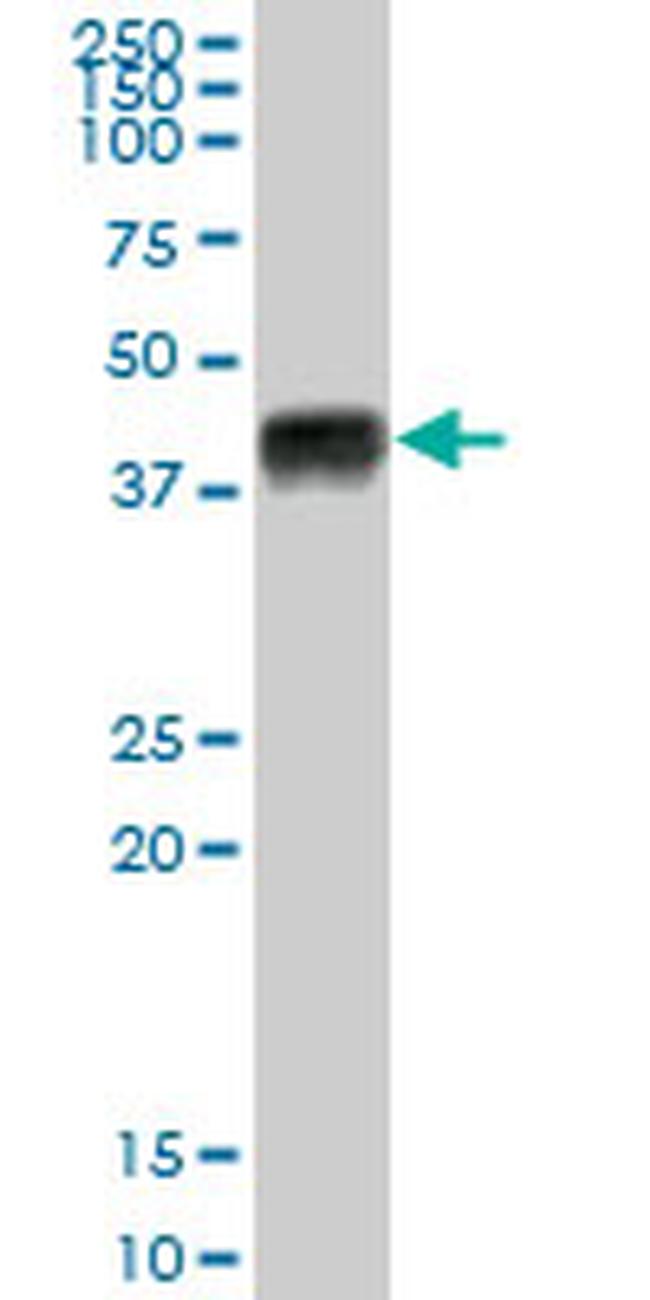 HLA-A Antibody in Western Blot (WB)