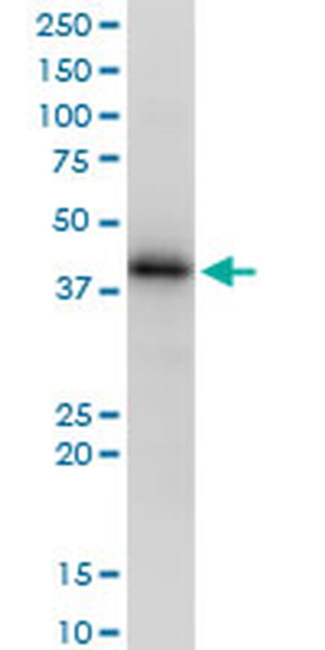 HLA-A Antibody in Western Blot (WB)