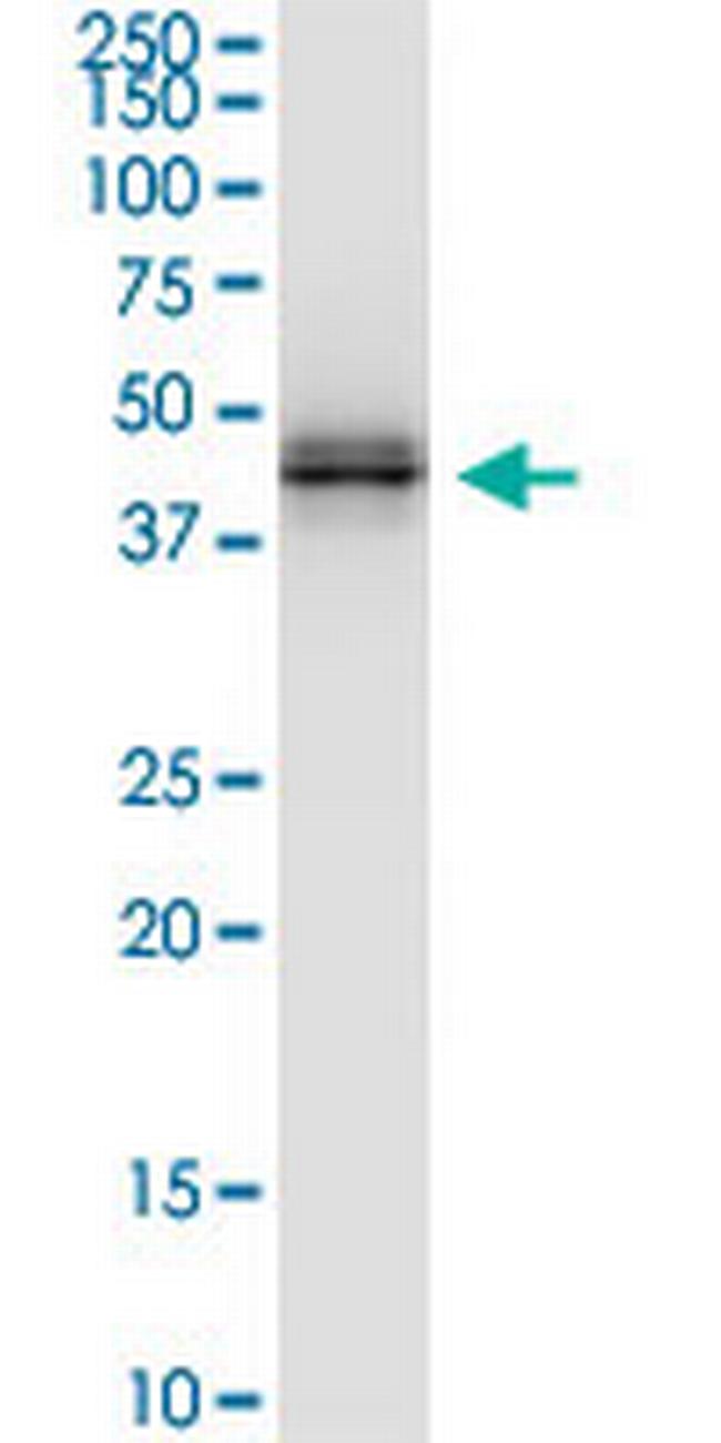 HLA-A Antibody in Western Blot (WB)