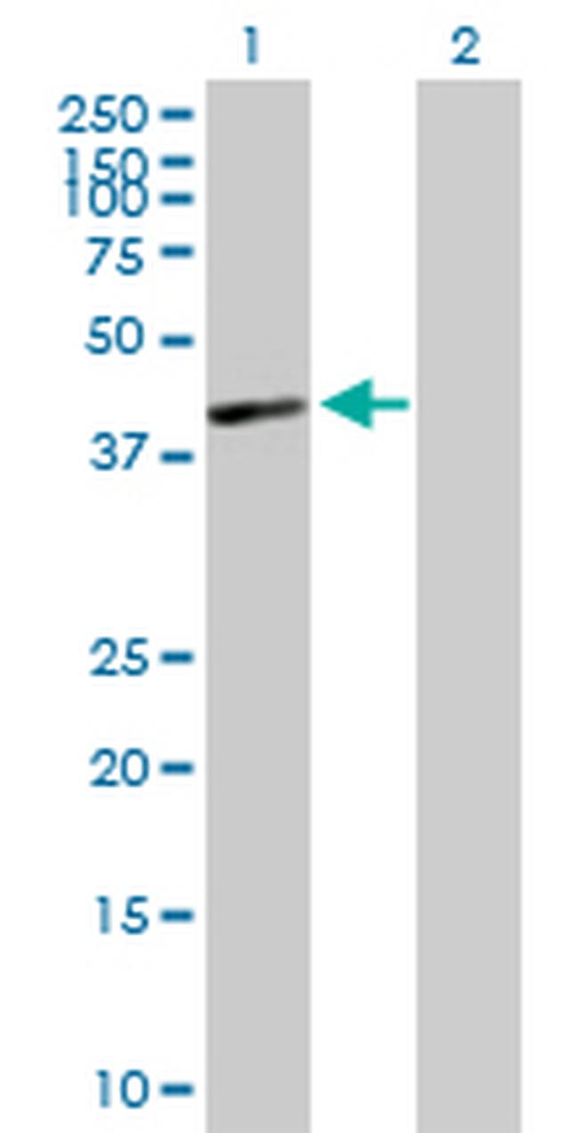 HLA-C Antibody in Western Blot (WB)