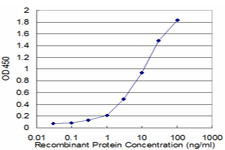 HLA-DMB Antibody in ELISA (ELISA)