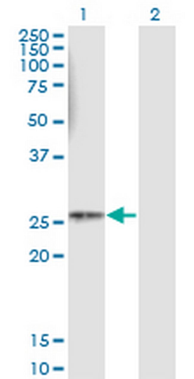 HLA-DMB Antibody in Western Blot (WB)