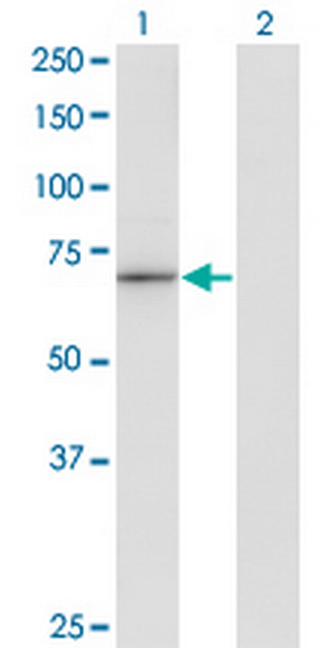 HLX1 Antibody in Western Blot (WB)