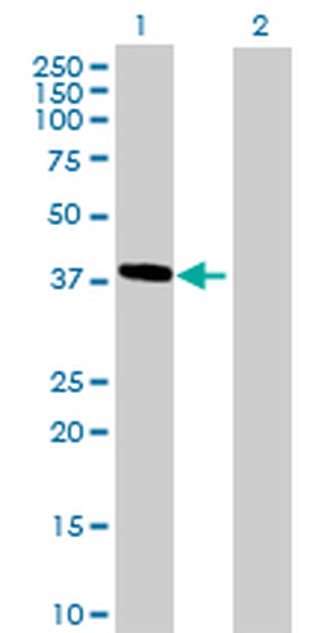 HMBS Antibody in Western Blot (WB)