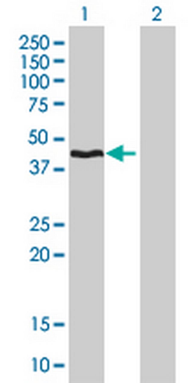 HMBS Antibody in Western Blot (WB)