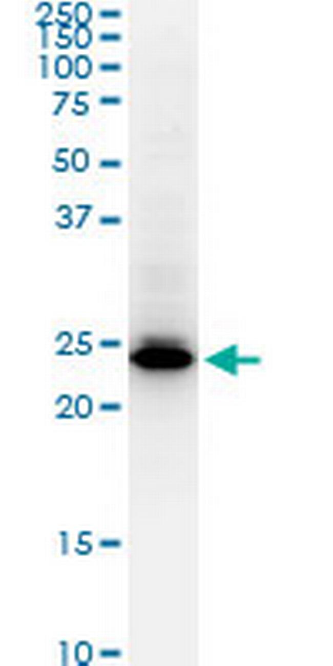 HMGB2 Antibody in Western Blot (WB)