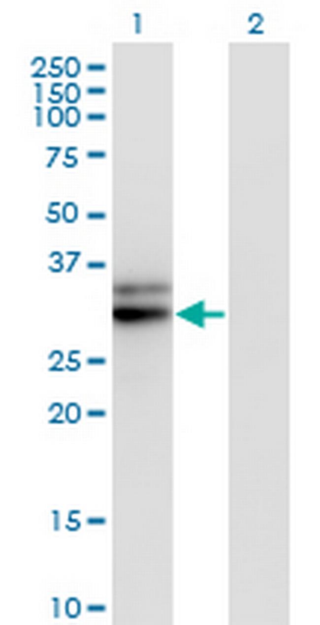 HMGCL Antibody in Western Blot (WB)