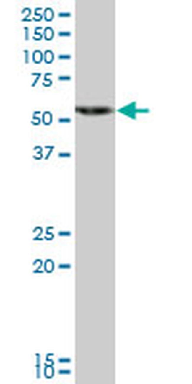 HMGCS1 Antibody in Western Blot (WB)