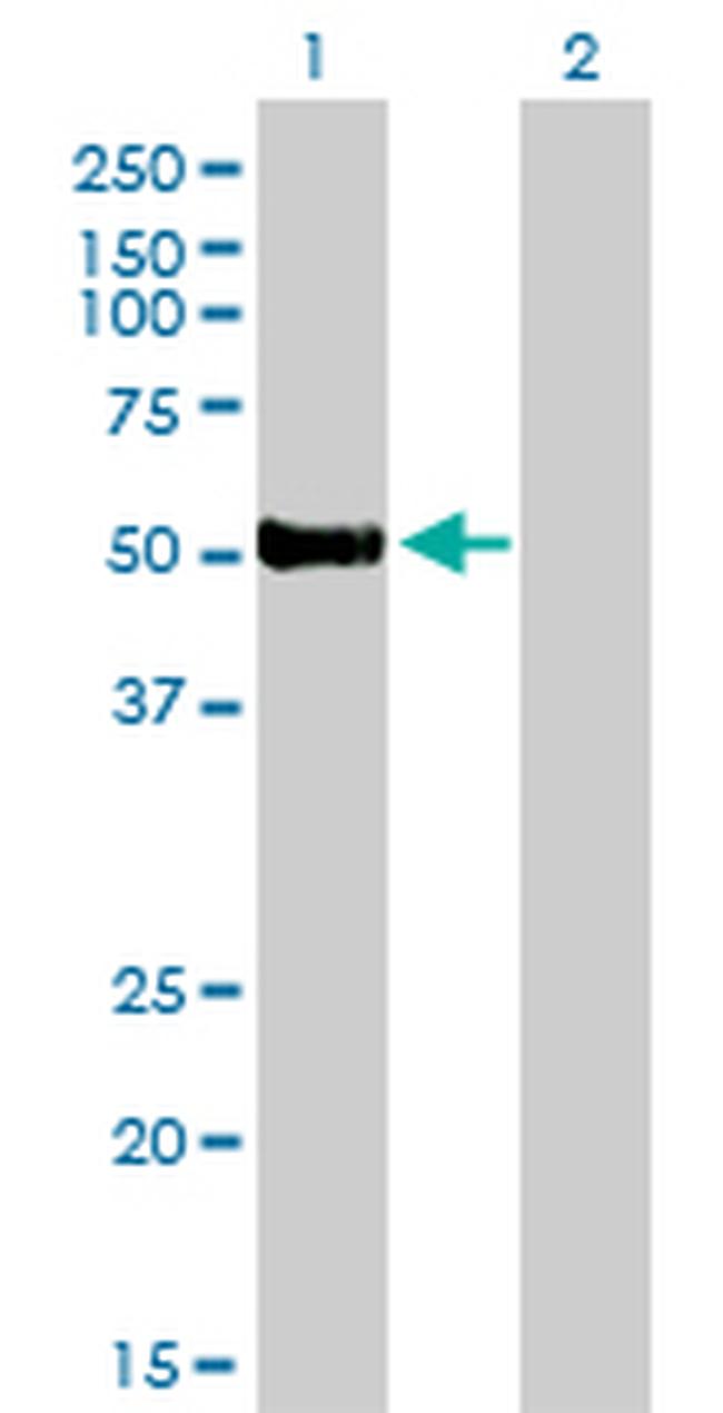 FOXA2 Antibody in Western Blot (WB)