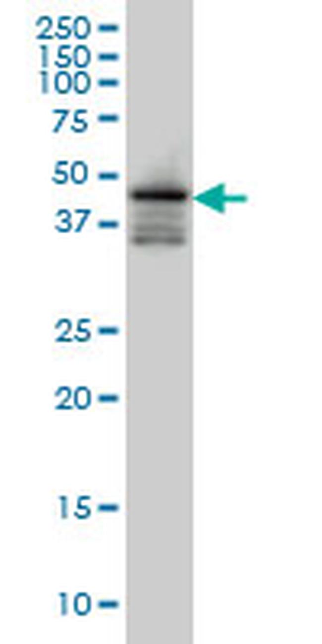 FOXA2 Antibody in Western Blot (WB)