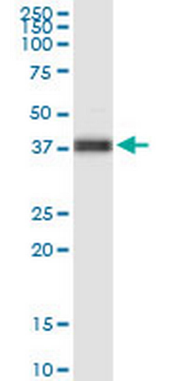 FOXA2 Antibody in Western Blot (WB)