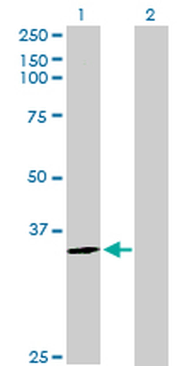 HNMT Antibody in Western Blot (WB)