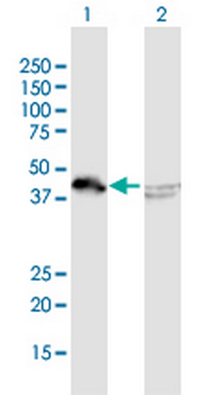 HNRPD Antibody in Western Blot (WB)