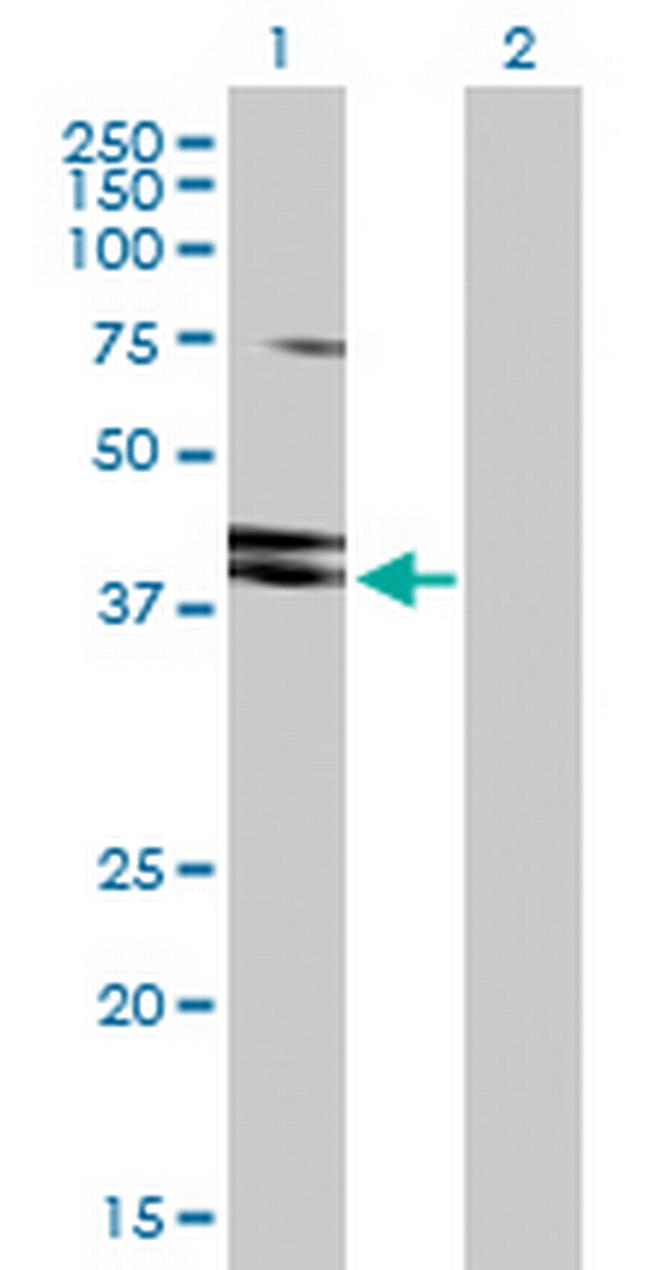 HNRNPD Antibody in Western Blot (WB)