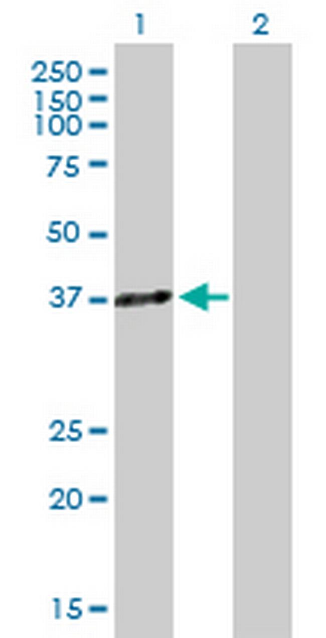 HOXA5 Antibody in Western Blot (WB)