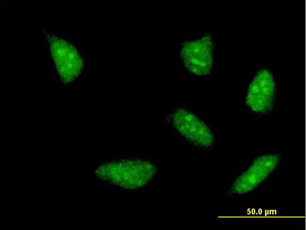 HOXA5 Antibody in Immunocytochemistry (ICC/IF)