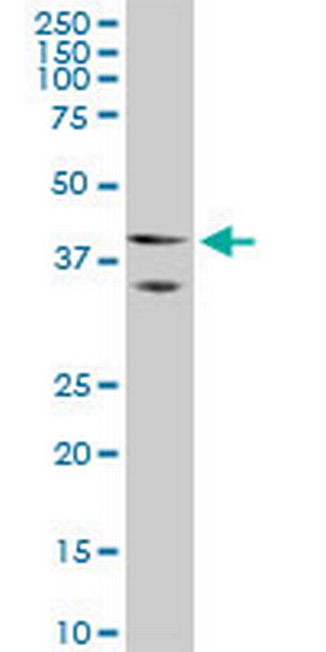 HOXA5 Antibody in Western Blot (WB)