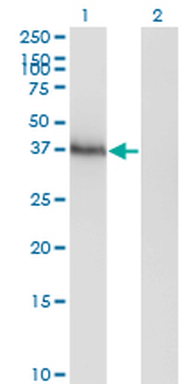 HOXA11 Antibody in Western Blot (WB)