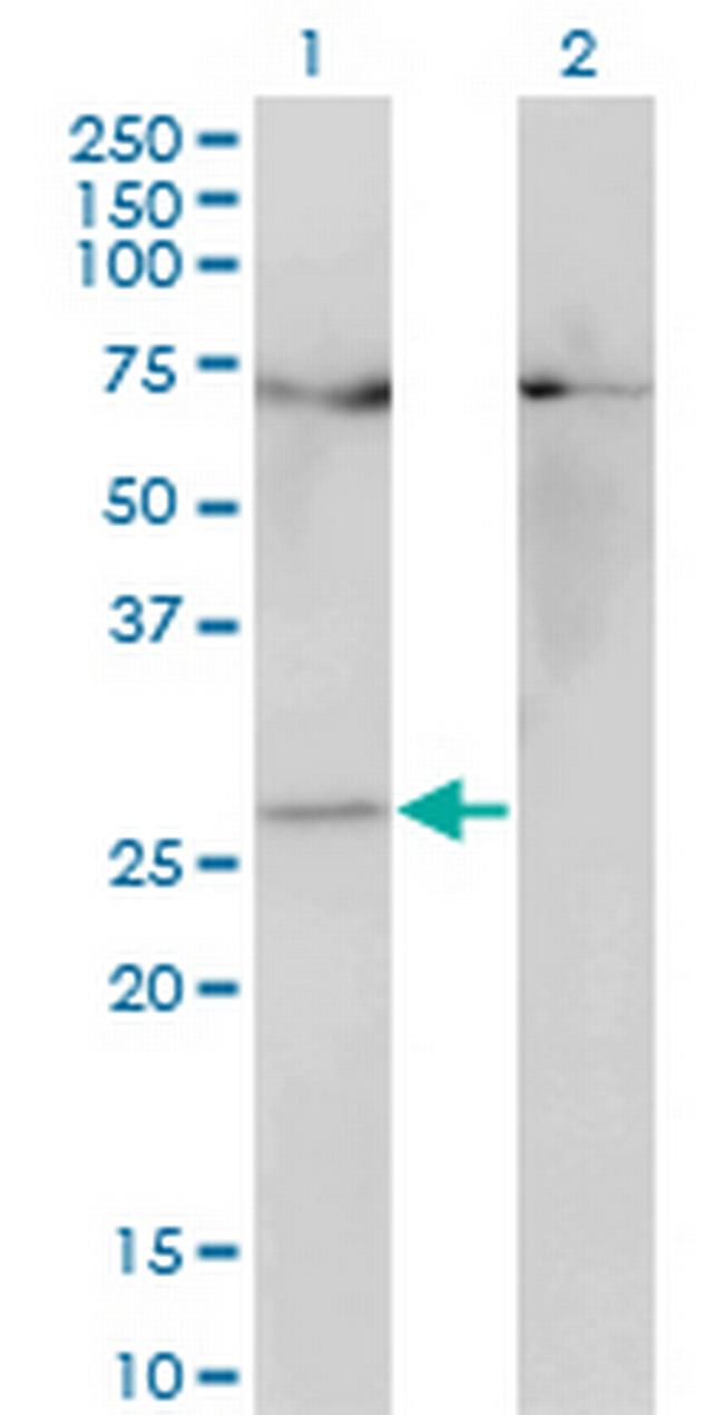 HOXB7 Antibody in Western Blot (WB)