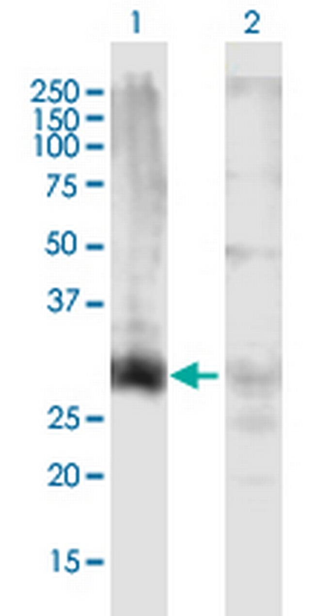 HOXD13 Antibody in Western Blot (WB)