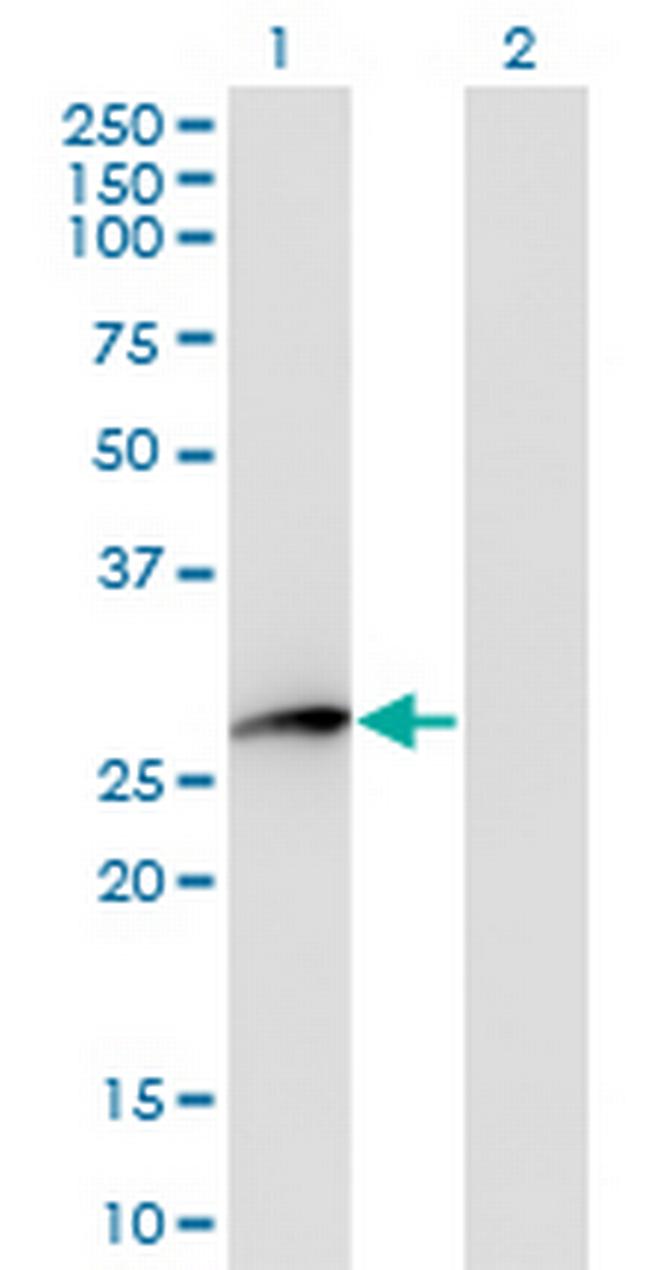 HPGD Antibody in Western Blot (WB)