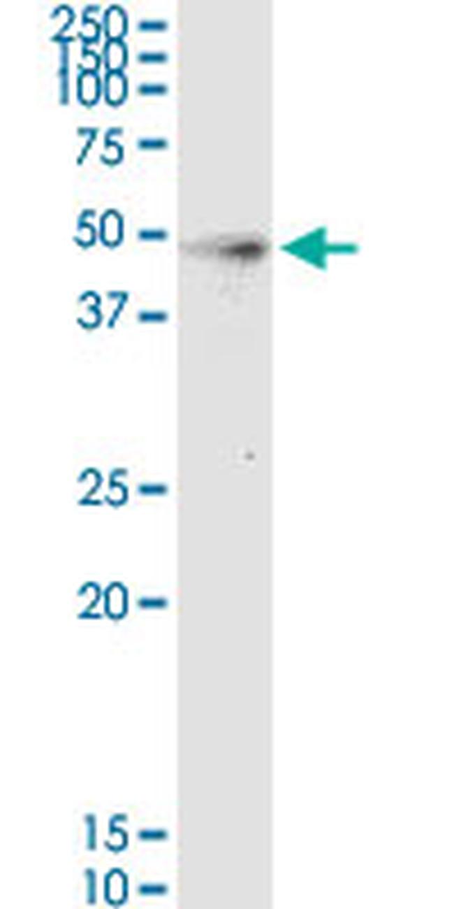 HPN Antibody in Western Blot (WB)