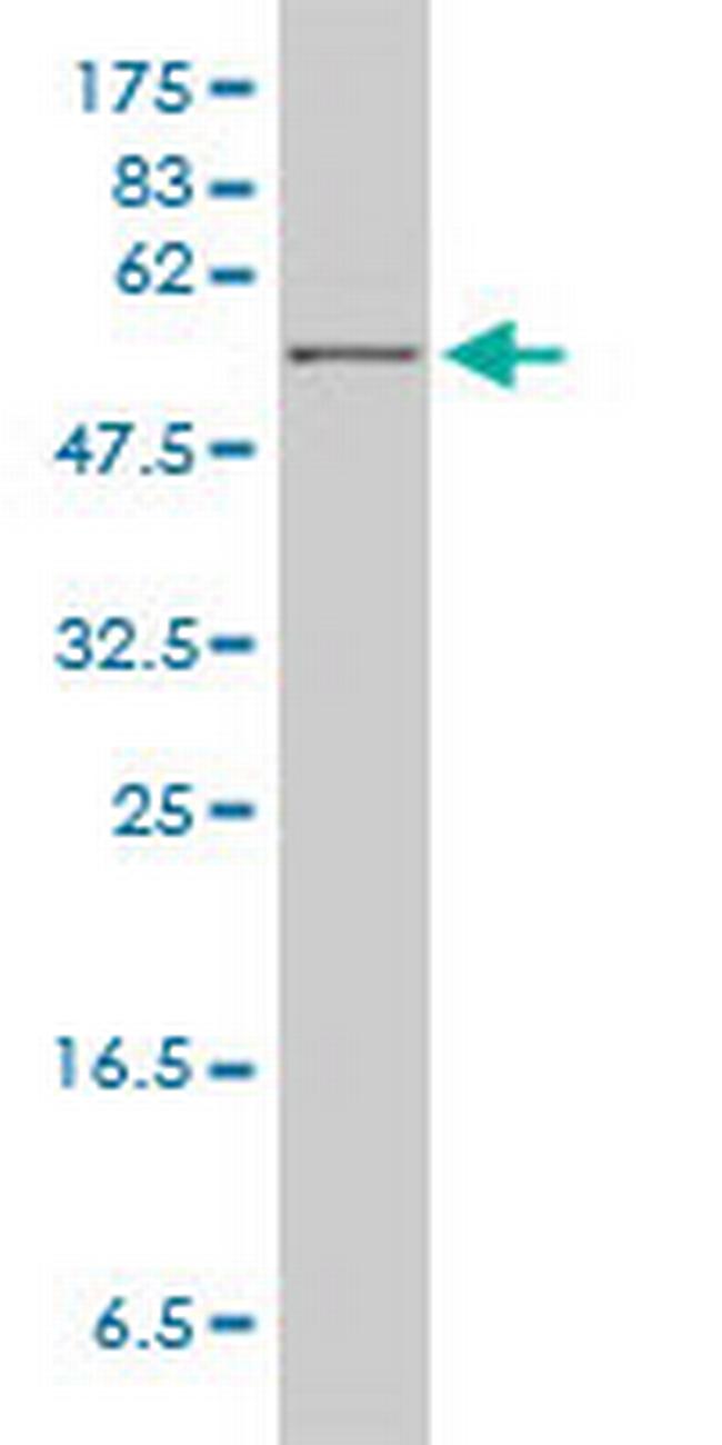 HPRT1 Antibody in Western Blot (WB)