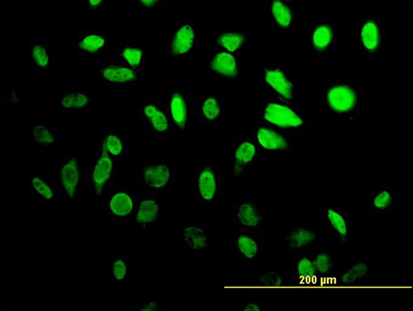 HES1 Antibody in Immunocytochemistry (ICC/IF)