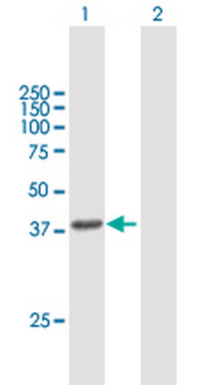 HSD3B1 Antibody in Western Blot (WB)