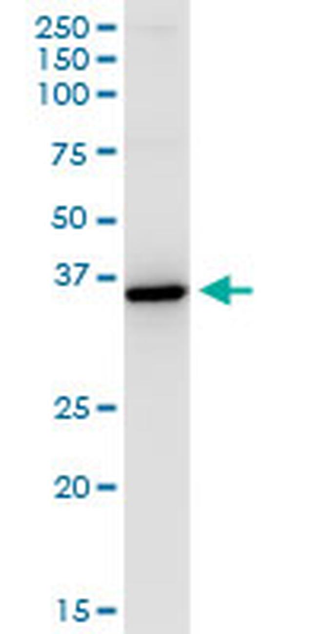 HSD11B1 Antibody in Western Blot (WB)